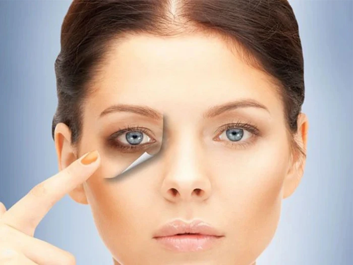 تیرگی زیر چشم 5345312