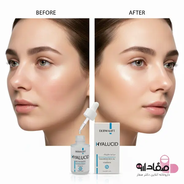 سرم هیالورونیک اسید درمالیفت 30 میلی لیتر 8546581