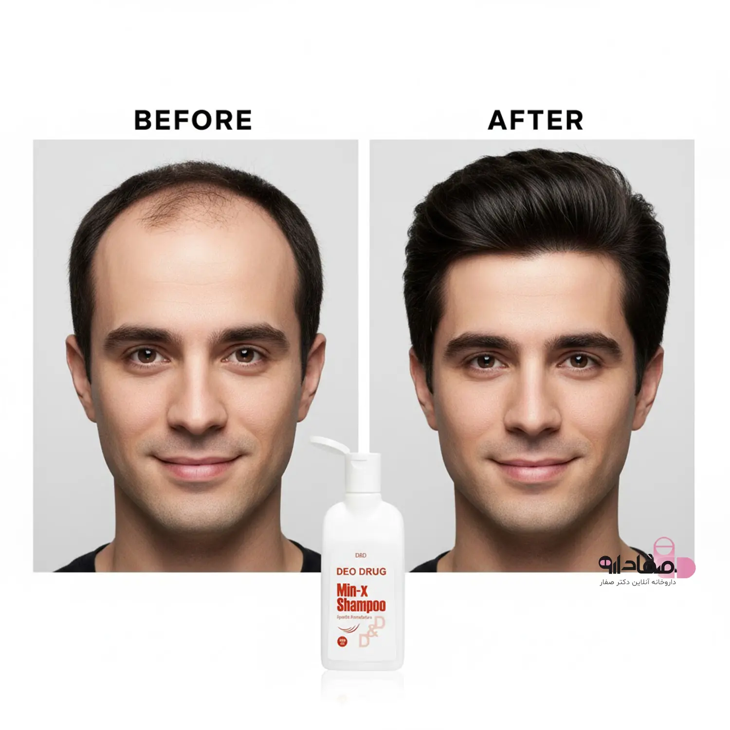 شامپو تقویت_کننده و ضد ریزش دئودراگ 6545641