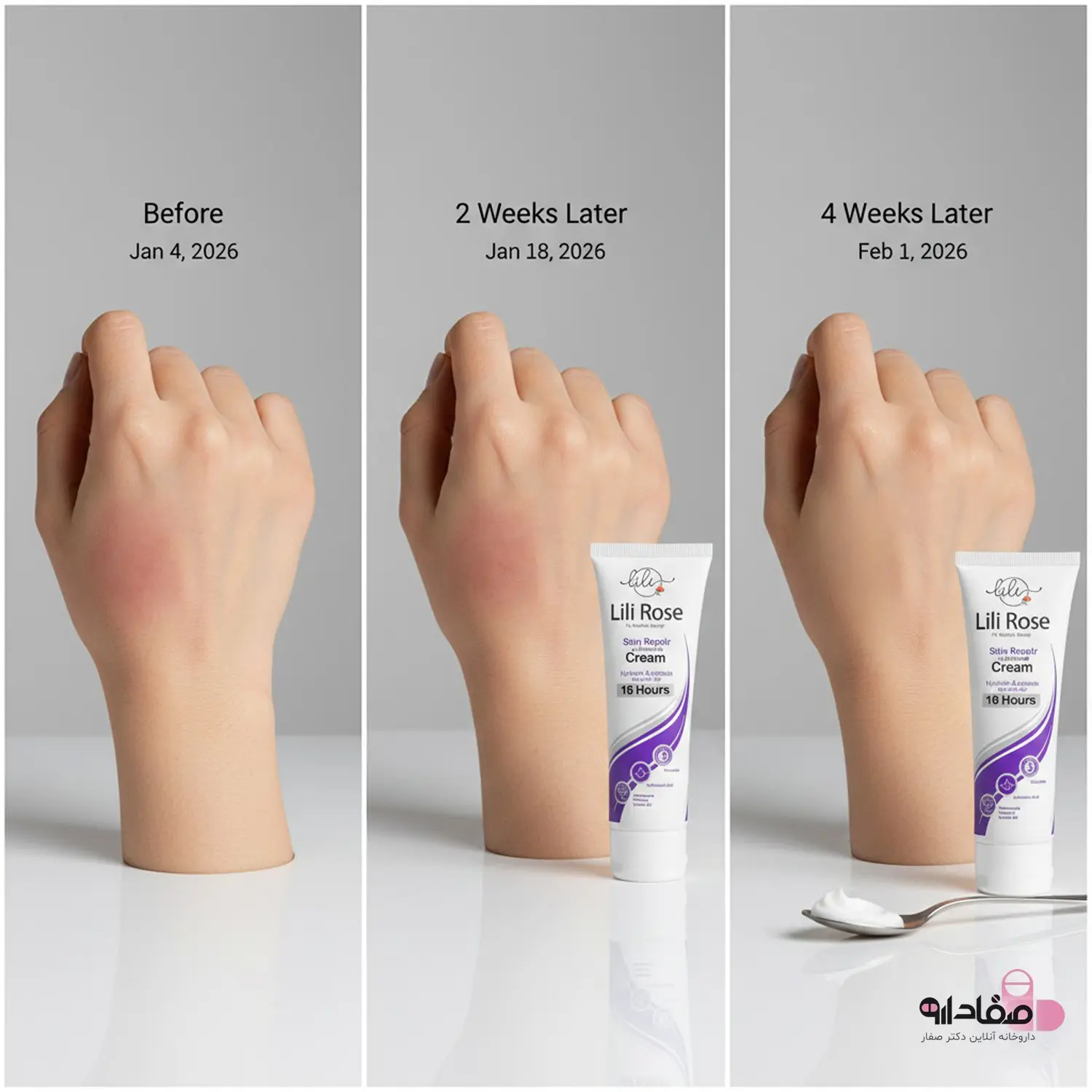 کرم ترمیم کننده پوست لیلی رز 584654312